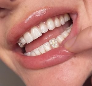 molarbaby Dentist in Potts Point
