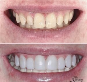 The Warm Smile - Dentist in Melbourne