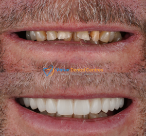 Value Dental Centres Melbourne Dentist in Hawthorn