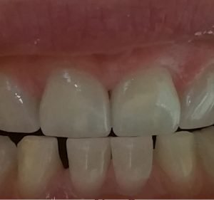 Dentist on Collins Dentist in Melbourne