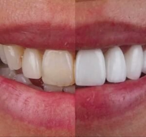 Preston Dentist | The Smile Designer Dentist in Preston