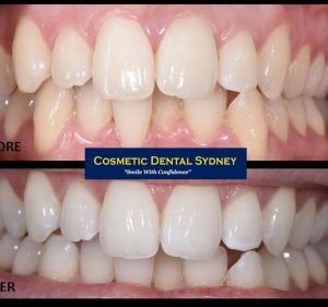 Cosmetic Dental Sydney Dentist in Kogarah