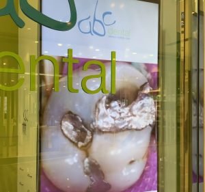 ABC Dental Dentist in Sydney