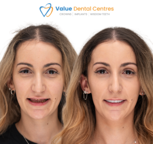 Dental Clinics in Victoria Australia Value Dental Centres Melbourne