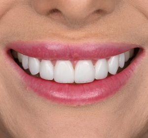 About Smiles Dental Circular Quay Dentist in Sydney