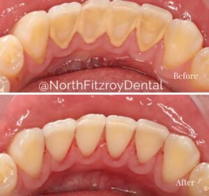 North Fitzroy Dental Dentist in Fitzroy North