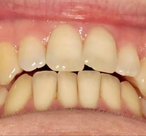 Dr Finkelstein Dentist Dentist in Sydney