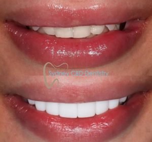 Sydney CBD Dentistry Dentist in Sydney
