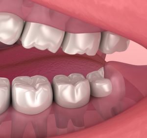 National Dental Care Barangaroo