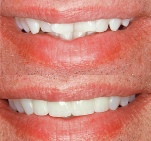 DR Dental South Yarra Dentist in South Yarra