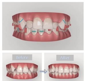 Dental Clinic @ World Tower Dentist in Sydney