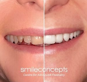 Smile Concepts Dentist in Sydney