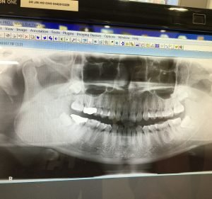 United Dental Care Dentist in Sydney