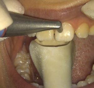 Dentessence Pty Ltd Dentist in Sydney