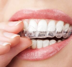 Dental Clinics in Melbourne Australia Gorgeous Smiles