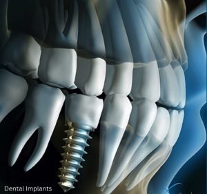 North Sydney Dental Practice Dentist in North Sydney