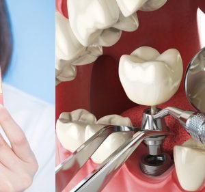 Clear Dental Sydney CBD | 牙醫 Dentist in Sydney