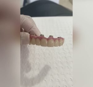 Sayers Dental Aesthetics & Implants Dentist in Hoppers Crossing