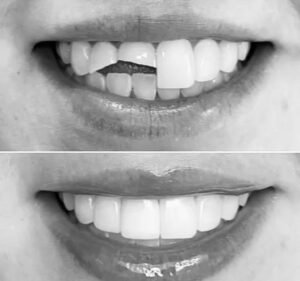 The Warm Smile - Dentist in Melbourne