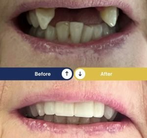 Sayers Dental Aesthetics & Implants Dentist in Hoppers Crossing