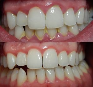 Dental Members Macquarie St Dentist in Sydney