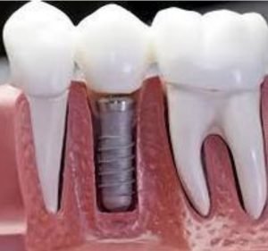 Dr Christopher Potter & Associates EdgecliffDentalTeam Dentist in Sydney
