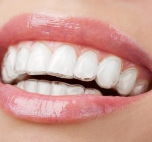 CDC Dental Dentist in Sydney