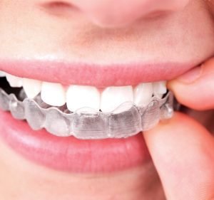  Sydney Dental Clinics - Bondi Junction