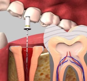 Dental Clinics in Melbourne Australia Dr. Leila Zamani Dental Practice