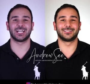 Advanced Dentistry Sydney Dentist in Hunters Hill