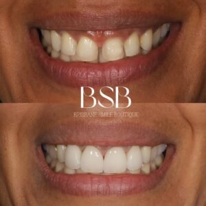 Brisbane Smile Boutique Dentist in Spring Hill