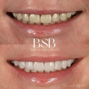 Brisbane Smile Boutique Dentist in Spring Hill