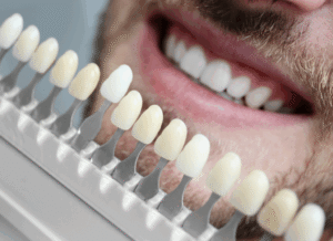 Rouse Hill Dentist | Hills Dental Boutique Dentist in Sydney